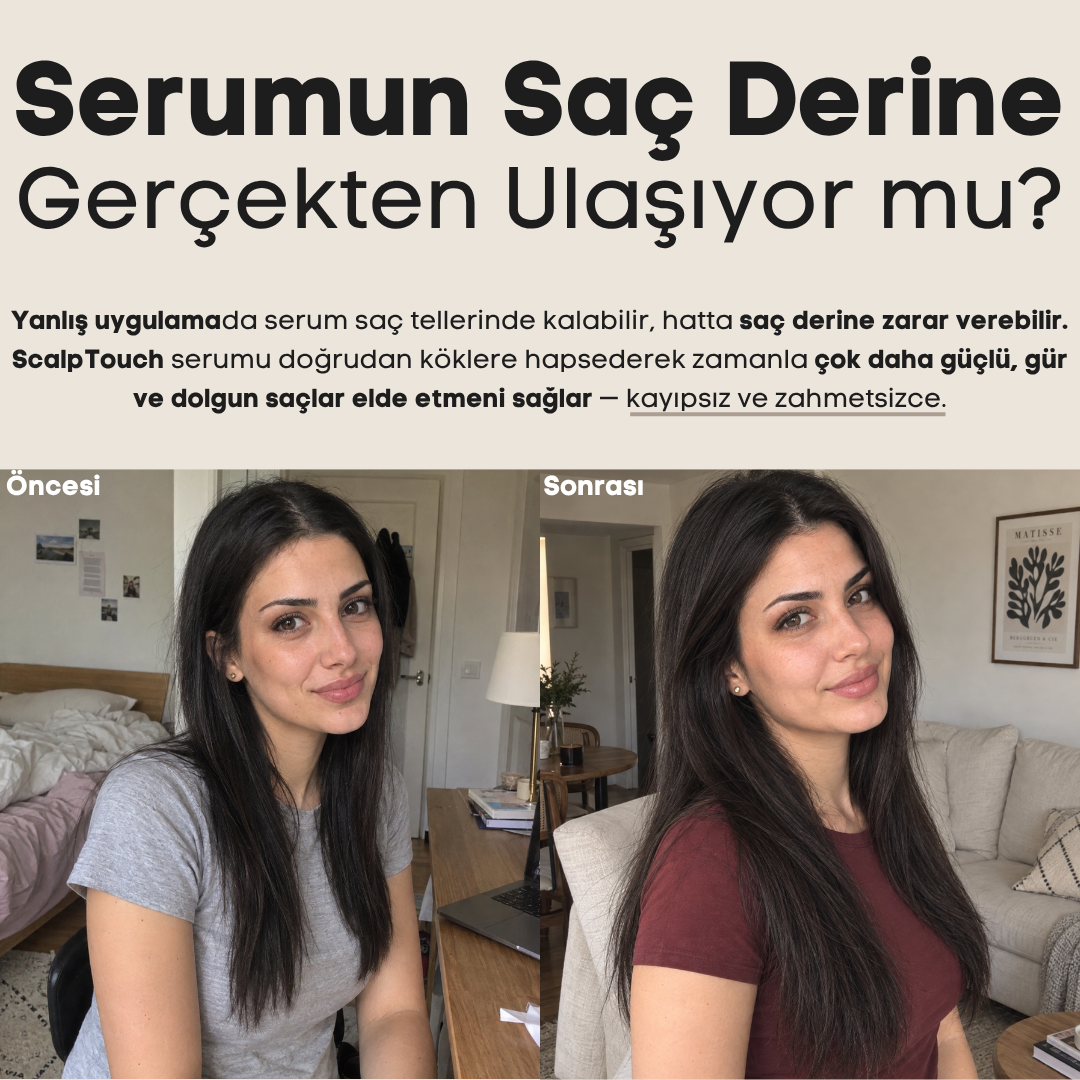 ScalpTouch™ Serum Uygulama Tarağı - Tara, Uygula, Bakımını Kolaylaştır.